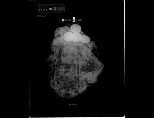 X-ray image of the lock .