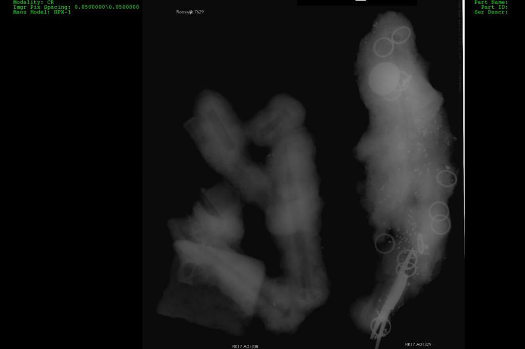 The x-ray of the concretion we worked on, on which you can clearly make out the candle snuffers, rings, coin and beads